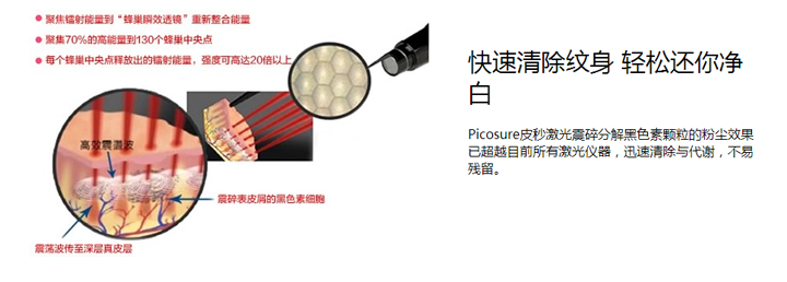 皮秒激光可以快速清除纹身,是清除纹身仪器 皮秒激光可以快速清除纹身,是清除纹身仪器